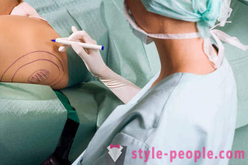 Plastickí chirurgovia zničiť stereotypy o svojej práci