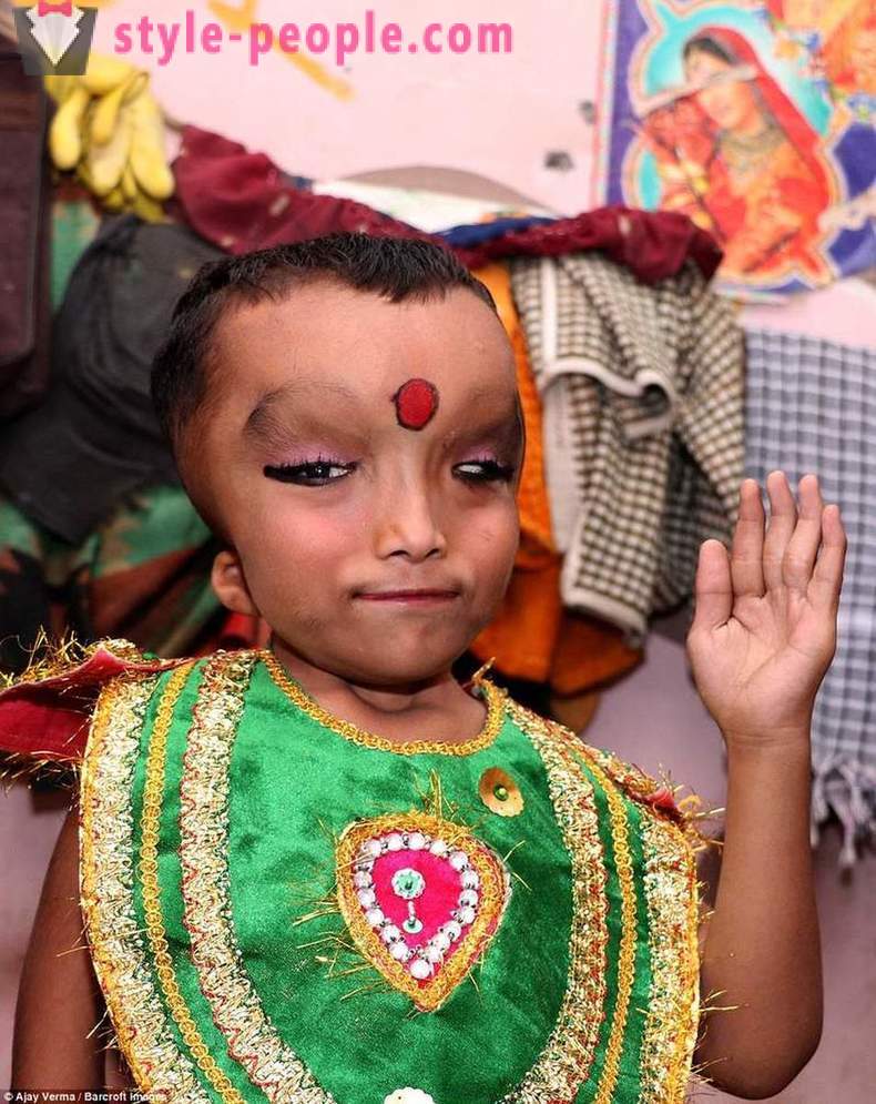 Indiánskej dediny je uctievaný chlapca s deformovanú hlavou ako boha Ganesha